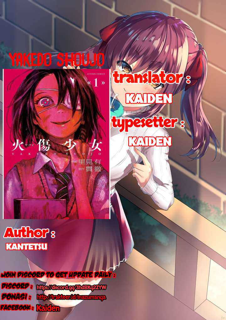 Komik Yakedo Shoujo Chapter 04 gambar 1